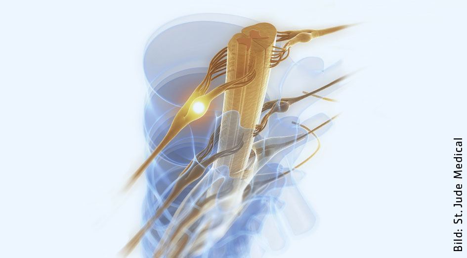 Interventionelle Schmerztherapie / RolandKlinik